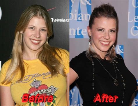 jodie sweetin boobs|Jodie Sweetin Plastic Surgery: Uncovering the Truth